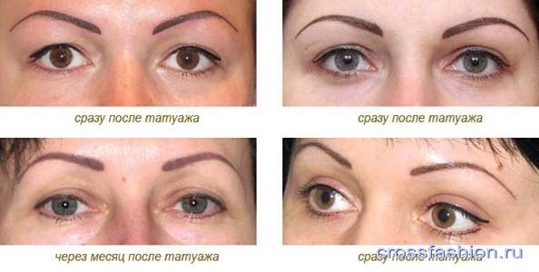 eyebrows-photo-after-6
